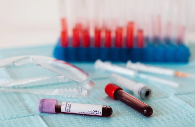 Тахмина Таги-заде: В этом году проведено 649 антидопинговых тестов
 