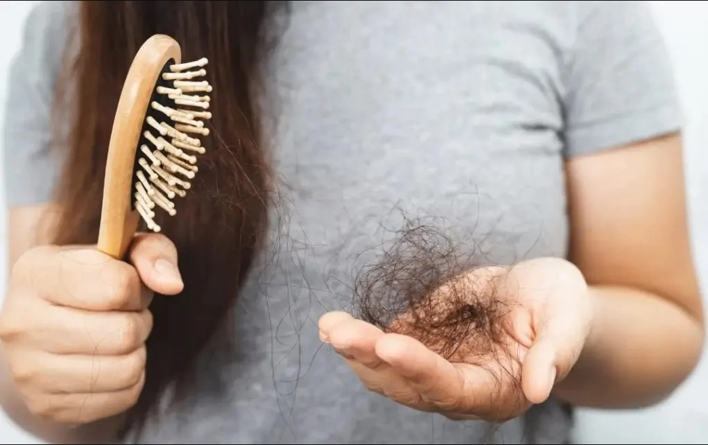 Названы неожиданные причины выпадения волос
 