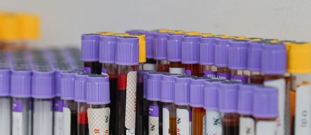 В Азербайджане более 700 желающих вступить в брак оказались носителями талассемии
 