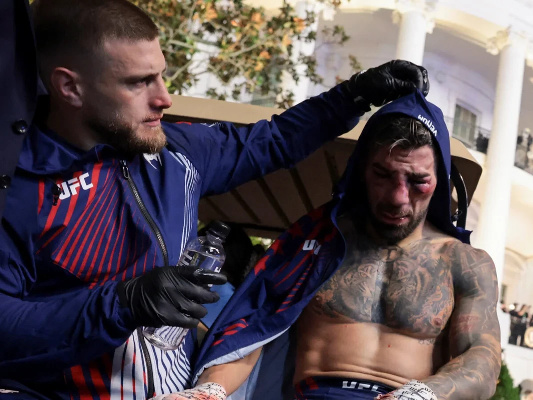 Топурию госпитализировали после поражения от Гейджи на турнире UFC
 
